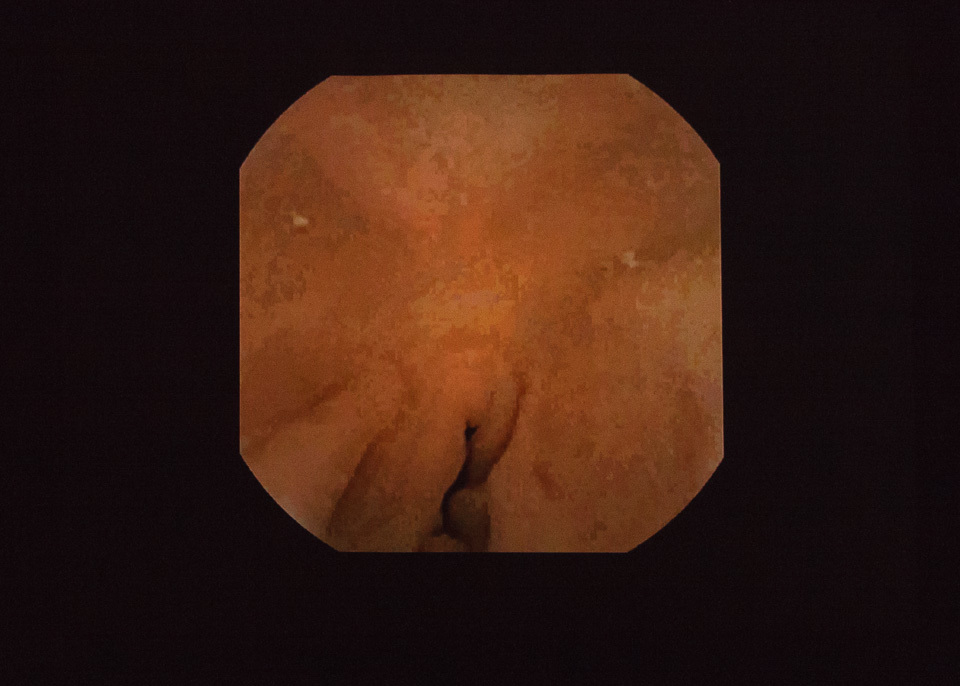 <p>Joe Caimo showing his insides</p>
